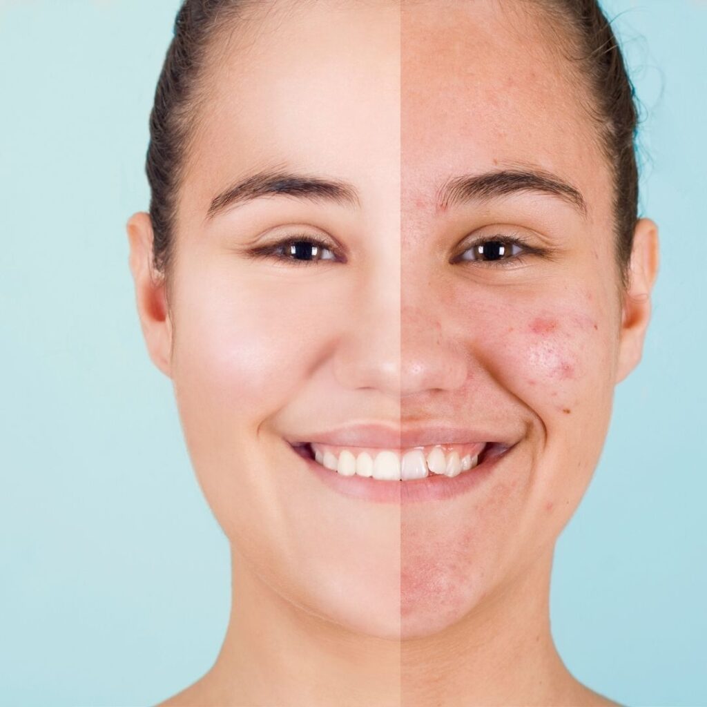 med spa Instagram marketing tips to attract botox and filler clients