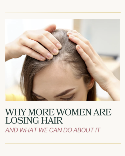 Why women losing hair